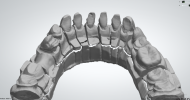 Preparation - lower jaw 1.png