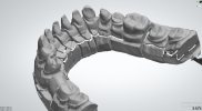 Preparation - lower jaw 2.png