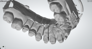 Preparation - upper jaw 3.png