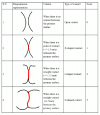 Diagrammatic-representation-of-the-type-of-contact-according-to-the-OXIS-scoring-criteria.png